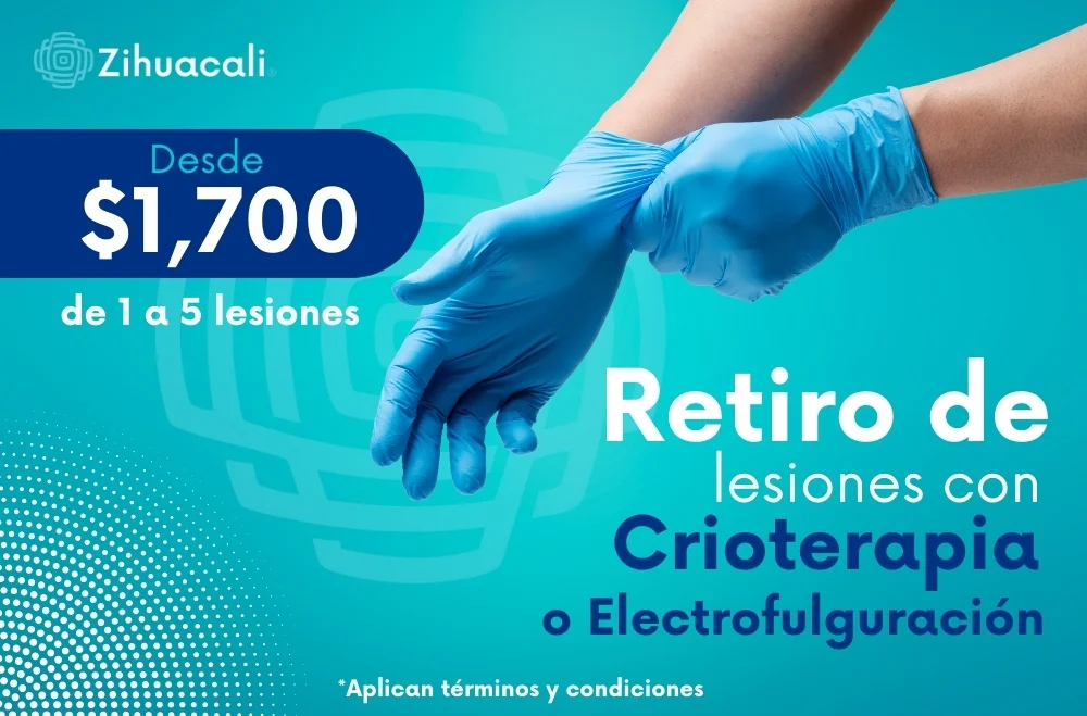 Retiro de lesiones